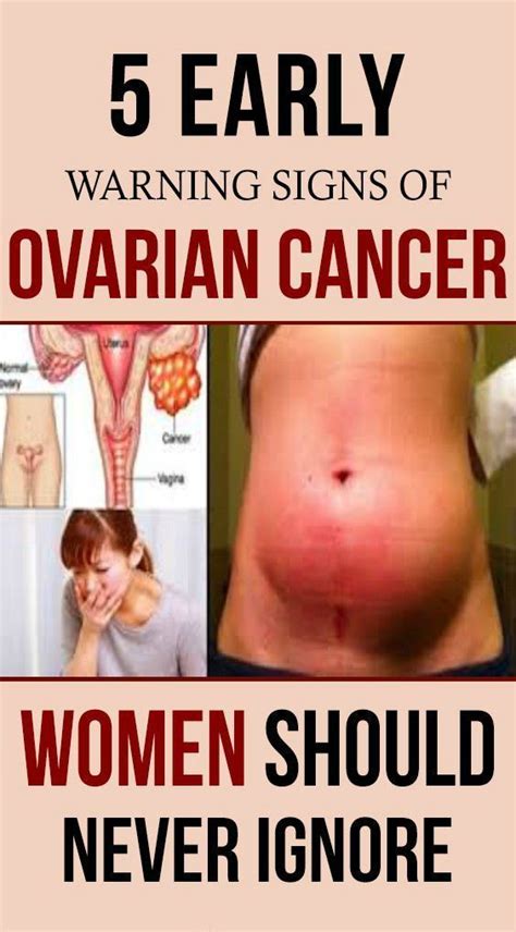 Pin On Signs Of Ovarian Cancer