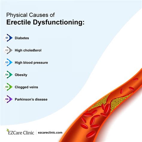 7 Common Causes Of Erectile Dysfunction Ezcare Clinic