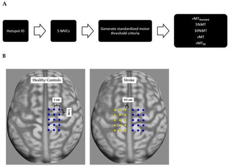 Jcm Special Issue Clinical Application Of Transcranial Magnetic