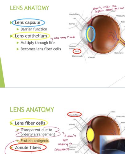 The Lens And Vitreous With Dr Henricksen Ophtho Flashcards Quizlet