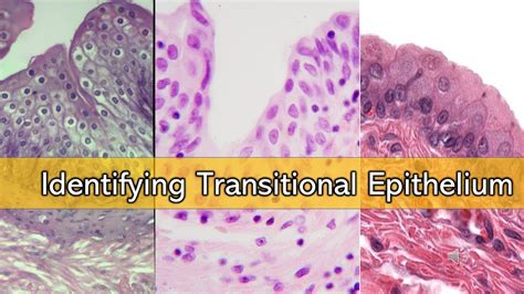 Identifying Transitional Epithelium YouTube