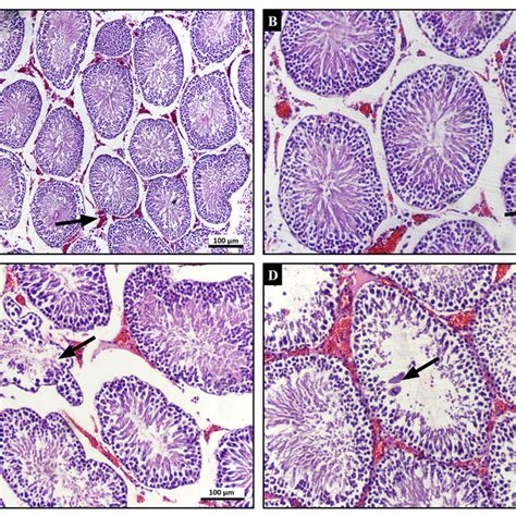 Representative Photomicrographs Of Hande Stained Testicular Sections Of