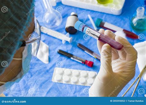 Creatinine Blood Test Tube Sample In Doctors Hand In Laboratory Stock