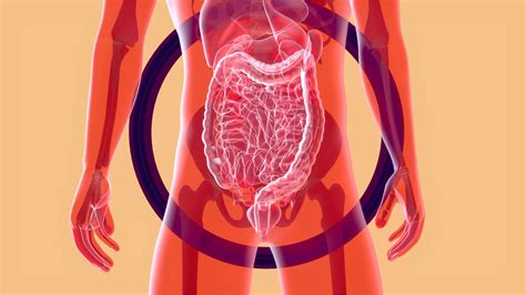 Cresce O Número De Casos De Câncer De Intestino No Brasil Canaltech