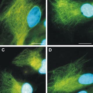 Nestin Expression In Primary Cultures Of Glioblastoma Cells