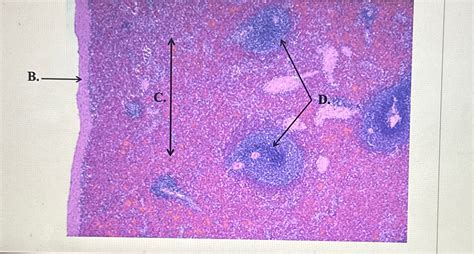 Solved Identify the lymphoid organ shown in the histology | Chegg.com