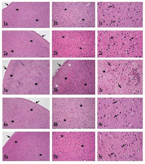 Adult Male Brain Histopathology A C Group Pia Mater Arrow