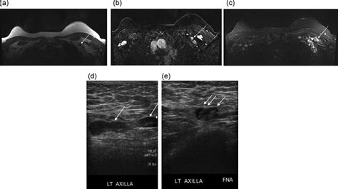 Axial T1 Weighted Sequence Without Fat Saturation A And Fat Download Scientific Diagram