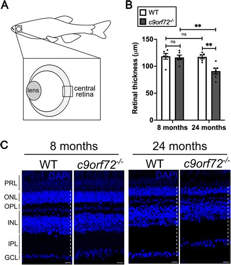 C9ORF72 Deficiency Results In Neurodegeneration In The Zebrafish Retina