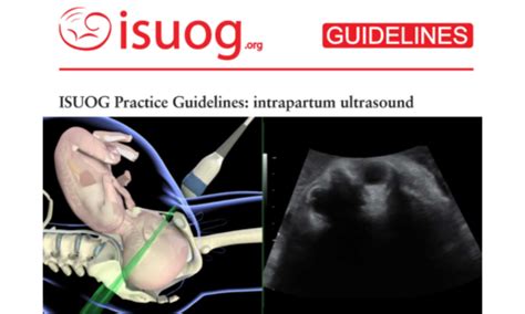 New Isuog Practice Guideline On Intrapartum Ultrasound Hot Sex Picture