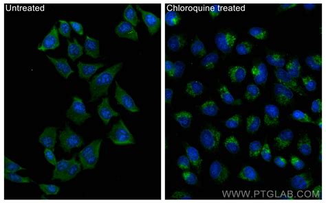 LC3 antibody (CL488-14600) | Proteintech