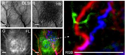 Images Of Tumor Micro Vascular Network In Mouse External Ear In Vivo