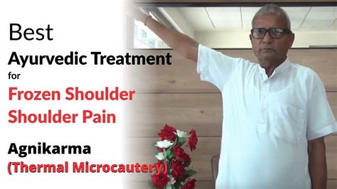 Best Ayurvedic Treatment For Frozen Shoulder Shoulder Pain Agnikarma Thermal Microcautery