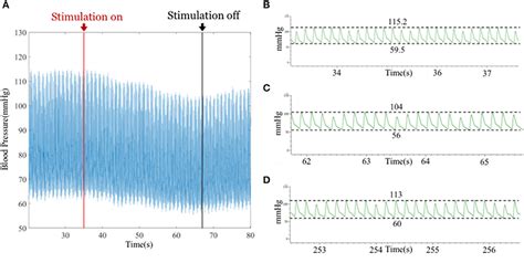 Frontiers A System Of Real Time Neural Recording And Stimulation And