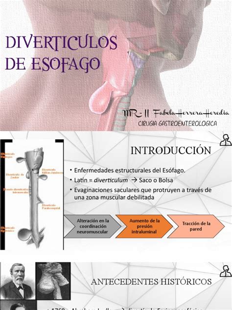 Diverticulos De Esofago Pdf Enfermedades Digestivas Gastroenterología