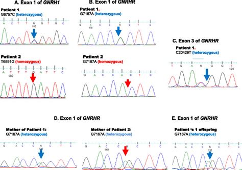 Sanger Sequencing Chromatograms Of Mutated Loci In Patients And Their