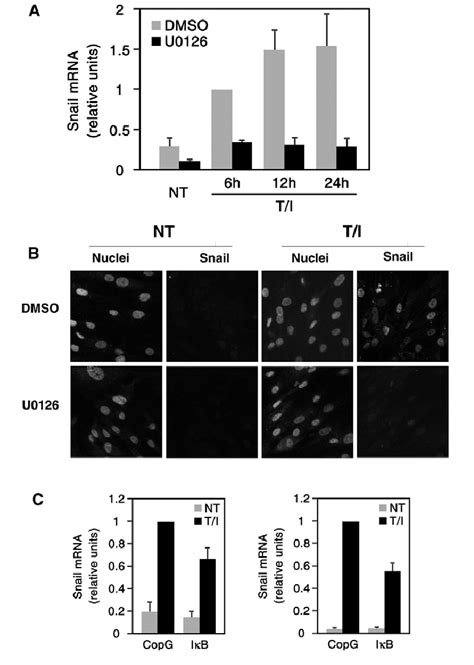 ERK and NF κB control Snail1 expression induced by TGF β1 plus IL 1β