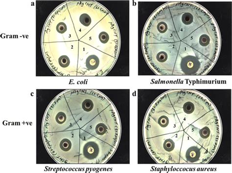 Zone Of Inhibition Test Using Kirby Bauer Disc Diffusion Assay Against Download Scientific