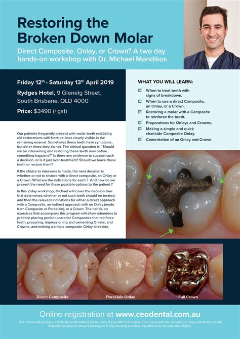 Restoring The Broken Down Molar Direct Composite Onlay Or Crown