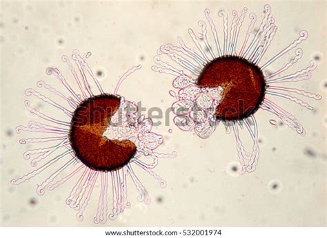 16 Fungus Mold Microscope Picture Images, Stock Photos & Vectors ...