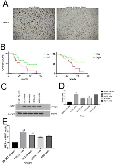 Her4 Expression In Both Osteosarcoma Specimens And Cell Lines A Her4