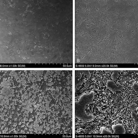 Scanning electron microscopy (SEM) examination of tooth enamel. (A ...