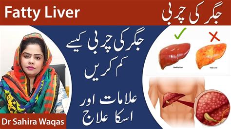 Fatty Liver Symptoms Treatment Jigar Ki Charbi Ka Ilaaj By Dr