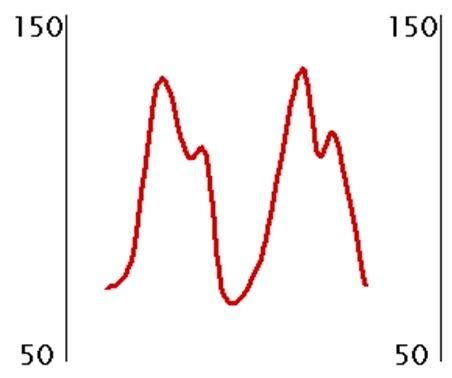 CCP Basic Hemodynamics Flashcards Quizlet