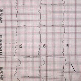 Electrocardiography at Emergency roomprocedure. | Download Scientific ...