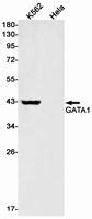 GATA1 Rabbit MAb NewEast Biosciences GTPase Oncogene And Bioactive