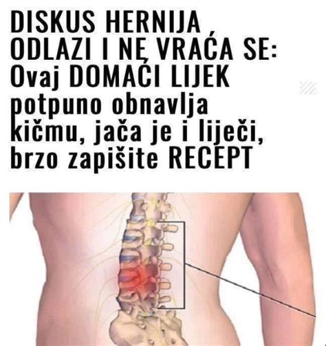 Diskus Hernija Ovaj Doma I Lijek Potpuno Obnavlja Ki Mu Ja A Je I