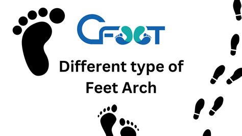 Exploring Different Types of Foot Arches: Flat Feet, High Arches, and Normal Arches – CFOOT STORE