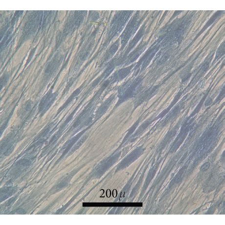 Cell Morphology A And C Human Gingival Cells Cultured In Complete