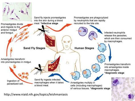 Ppt Leishmaniasis Powerpoint Presentation Free Download Id2188347