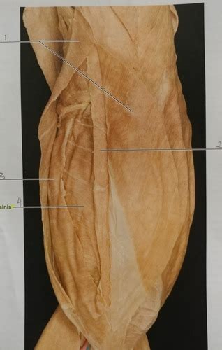 Muscles Of Abdominal Wall Flashcards Quizlet