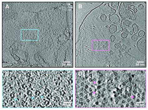 Cryo Electron Tomography Cryoet Revealed Two Ring Like Structures In