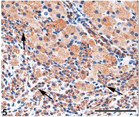 Uterus B6c3f1 Mouse No 1 Granular Cell Tumor At Uterine Cervix Download Scientific Diagram