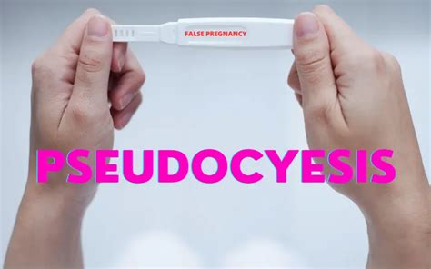 Is It Real Or Pseudocyesis Distinguishing Genuine From False Pregnancy