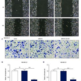 Upregulation Of COL10A1 Boosted The Migration And Invasion Of Breast