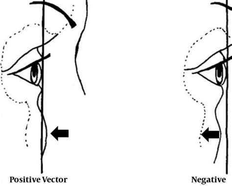 Positive and negative vector relation | Download Scientific Diagram