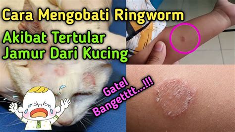 Cara Mengobati Ringworm Akibat Tertular Jamur Dari Kucing YouTube