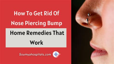 How To Get Rid Of Nose Piercing Bump: Home Remedies That Work - soumyahospitals.com