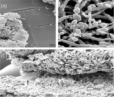 Fungal Biofilm Images In Scanning Electron Microscopy A Panoramic View