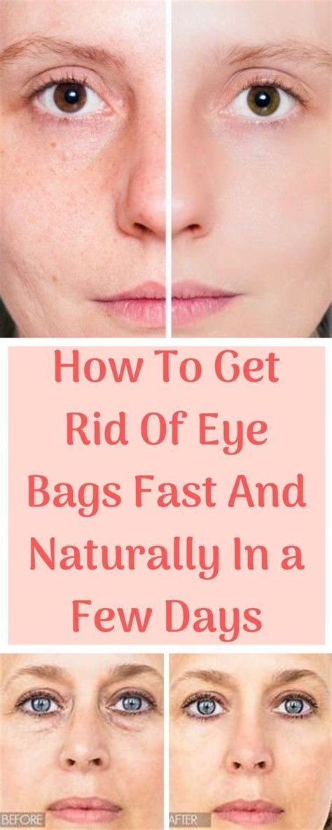 How To Get Rid Of Under Eye Bags Food Culinary