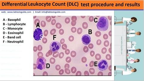 Differential Leukocyte Count Dlc Test Procedure Lab Tests Guide