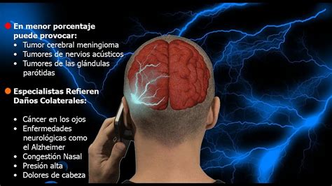 S Ntomas Tumor Cerebral Prevenci N Y Tratamiento