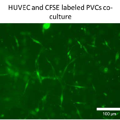 Endothelial Tube Formation Of Human Umbilical Cord Vein Endothelial