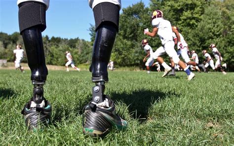 Ohio Defensive End Wants To Become First Nfl Player With Prosthetic Legs