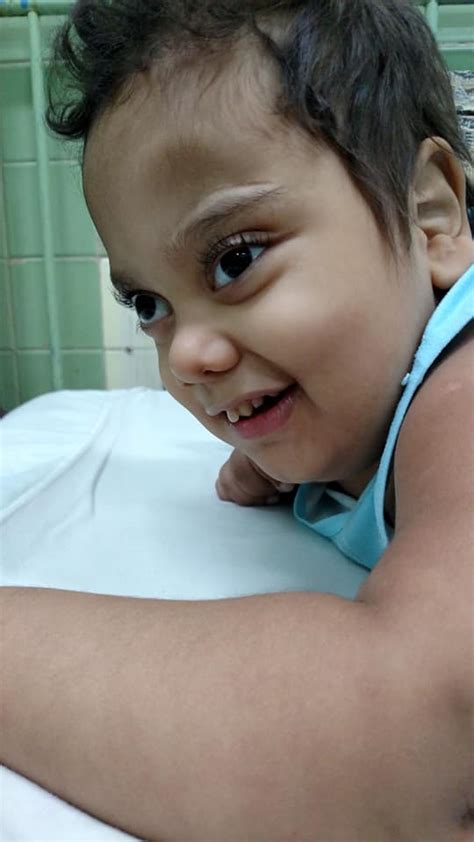 Niño cubano de 4 años padece de tumor cerebral Su madre pide ayuda