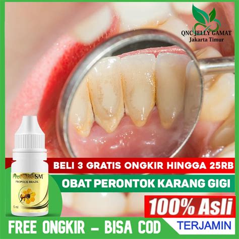 Jual Obat Perontok Karang Gigi Gigi Kuning Gigi Berlubang